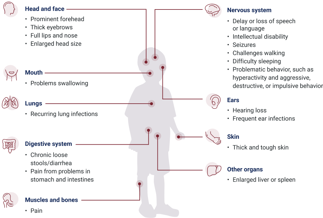 Illustration depicting some of the possible signs and symptoms of MPS III